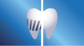 Elimina de pana la 2 ori mai multa placa bacteriana decat o periuta de dinti manuala