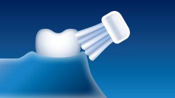 Mod sensibil: Curatare delicata a dintilor si a gingiilor